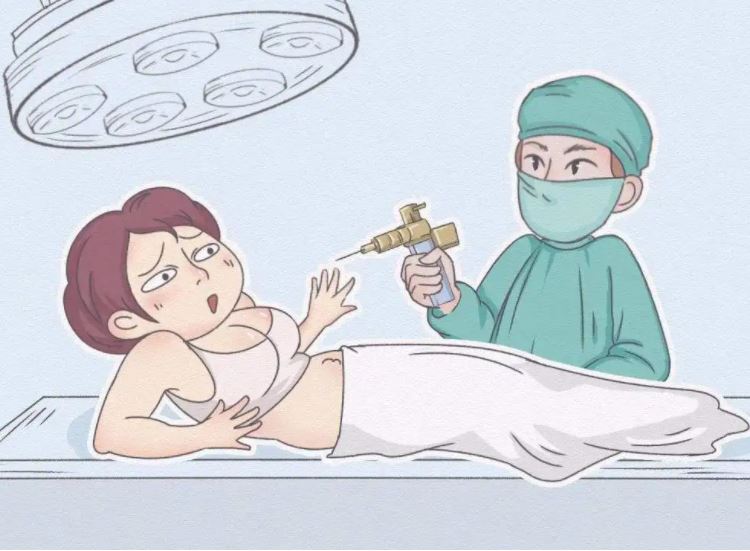 全身抽脂對(duì)身體有什么傷害？