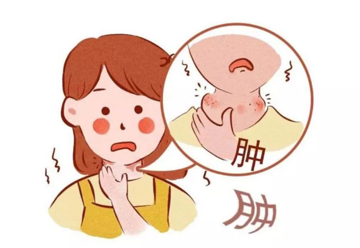 扁桃體發(fā)炎吃什么藥好得快？扁桃體發(fā)炎飲食禁忌有哪些？